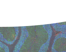 Polyclonal Antibodies